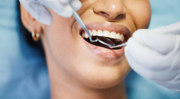 Best Emergency Treatment for Dental Infections or Abscesses in Jacksonville, NC