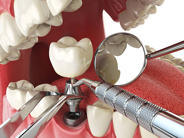 Best Emergency Dental Care for Broken or Chipped Teeth in Jacksonville, NC